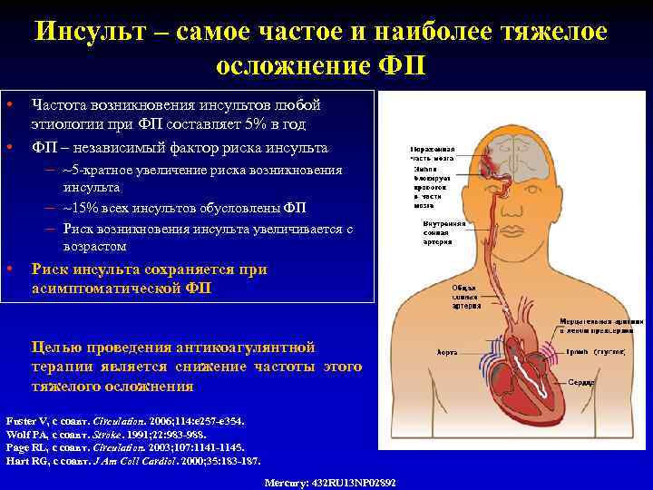 Инсульт – самое частое и наиболее тяжелое осложнение ФП • Частота возникновения инсультов любой