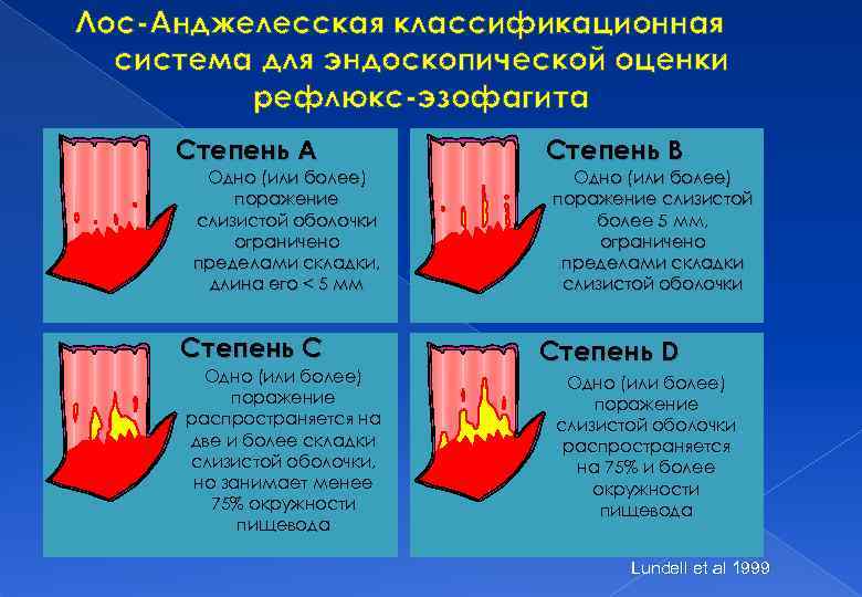 Лос-Анджелесская классификационная система для эндоскопической оценки рефлюкс-эзофагита Степень A Одно (или более) поражение слизистой