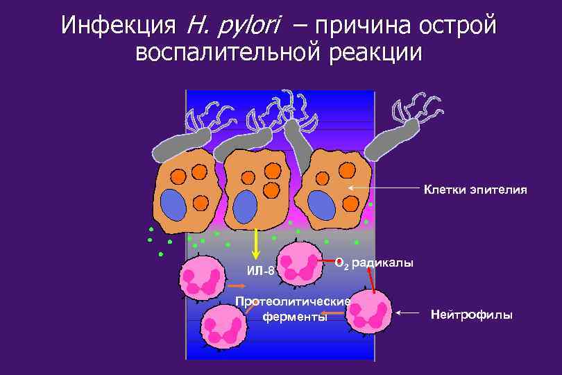 Инфекция H. pylori – причина острой воспалительной реакции Клетки эпителия ИЛ-8 O 2 радикалы