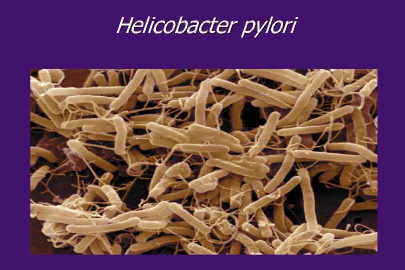 Helicobacter pylori 