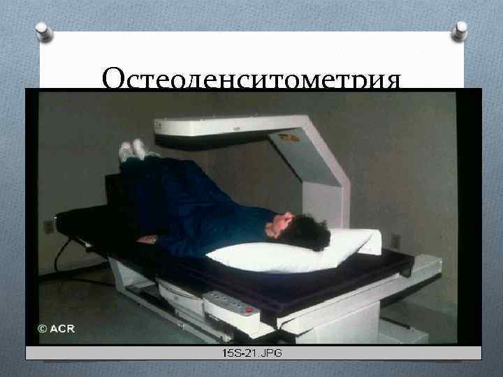 Остеоденситометрия 