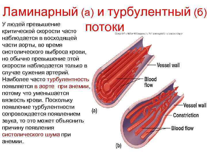 Ламинарный (а) и турбулентный (б) У людей превышение критической скорости часто потоки наблюдается в