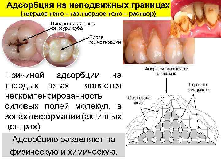 Адсорбция на неподвижных границах (твердое тело – газ; твердое тело – раствор) Пигментированные фиссуры