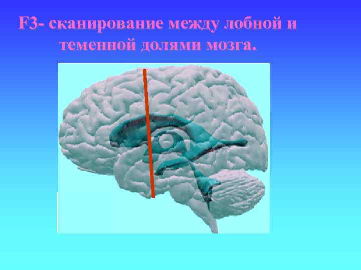 F 3 - сканирование между лобной и теменной долями мозга. 