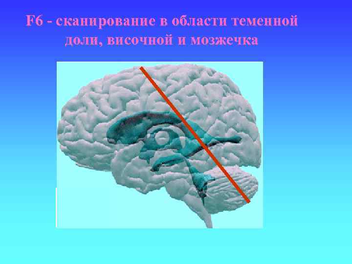 F 6 - сканирование в области теменной доли, височной и мозжечка 