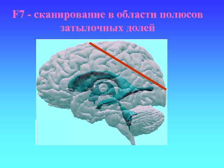 F 7 - сканирование в области полюсов затылочных долей 