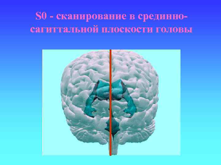 S 0 - сканирование в срединносагиттальной плоскости головы 