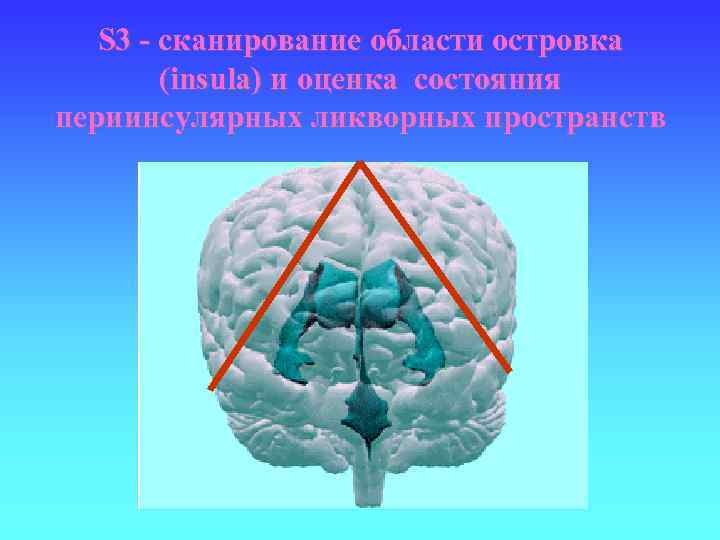 S 3 - сканирование области островка (insula) и оценка состояния периинсулярных ликворных пространств 