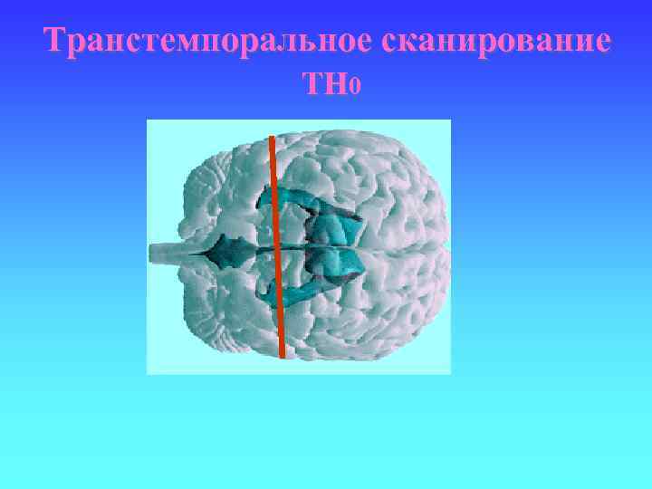 Транстемпоральное сканирование TH 0 