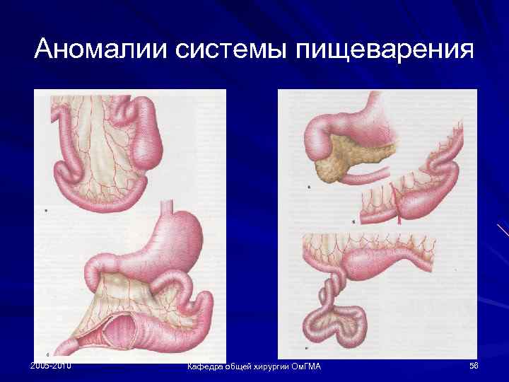 Аномалии системы пищеварения 2005 -2010 Кафедра общей хирургии Ом. ГМА 56 