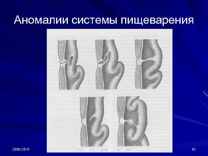 Аномалии системы пищеварения 2005 -2010 Кафедра общей хирургии Ом. ГМА 63 