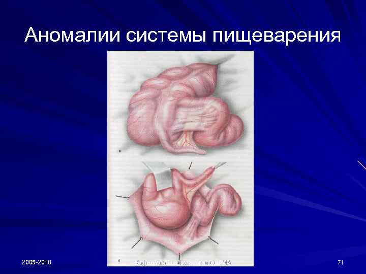 Аномалии системы пищеварения 2005 -2010 Кафедра общей хирургии Ом. ГМА 71 