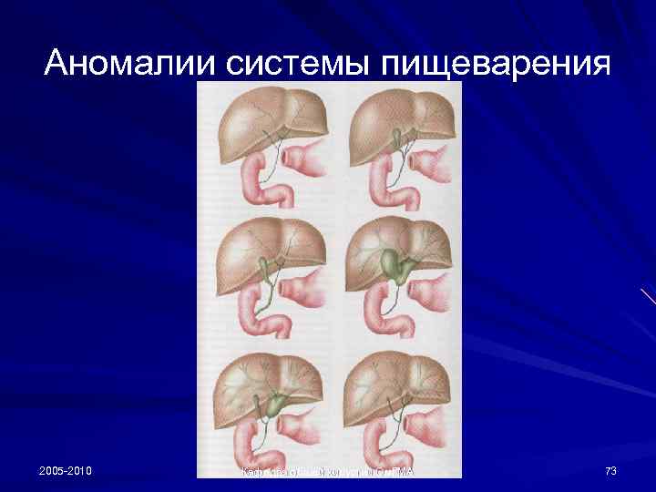 Аномалии системы пищеварения 2005 -2010 Кафедра общей хирургии Ом. ГМА 73 