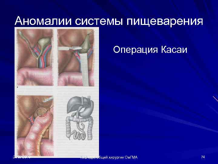 Аномалии системы пищеварения Операция Касаи 2005 -2010 Кафедра общей хирургии Ом. ГМА 74 