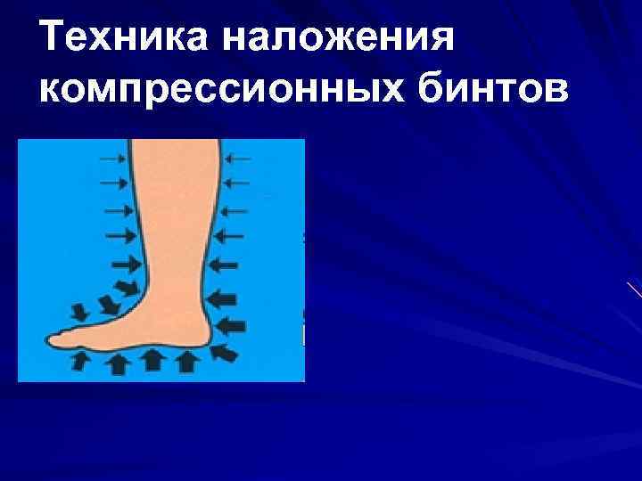 Техника наложения компрессионных бинтов 