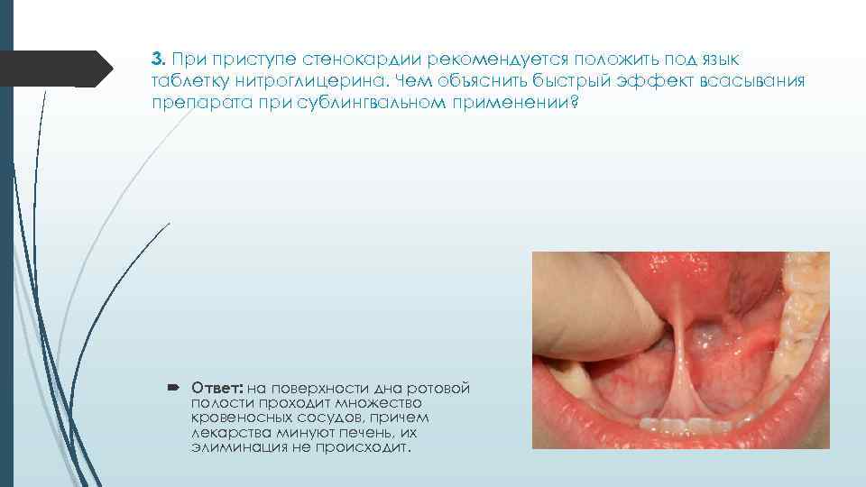 3. При приступе стенокардии рекомендуется положить под язык таблетку нитроглицерина. Чем объяснить быстрый эффект