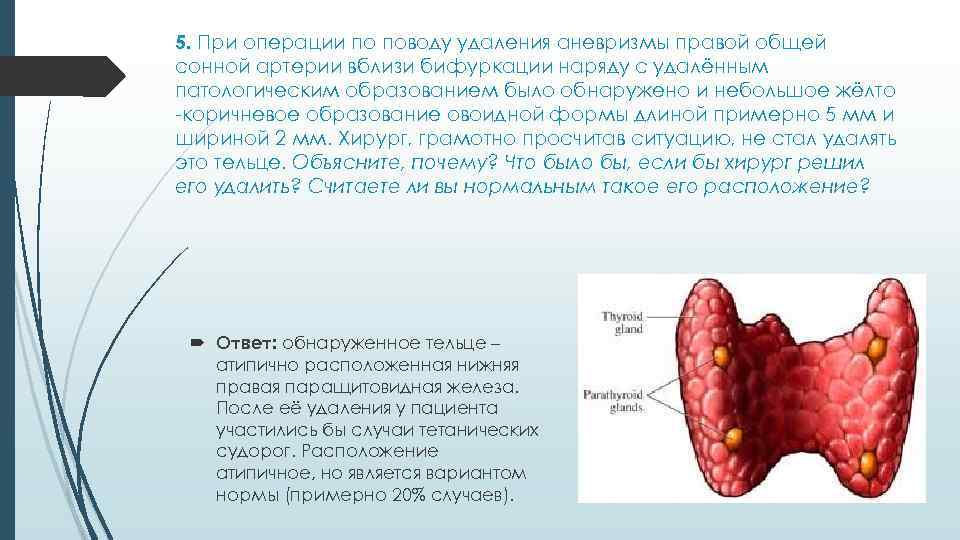 5. При операции по поводу удаления аневризмы правой общей сонной артерии вблизи бифуркации наряду