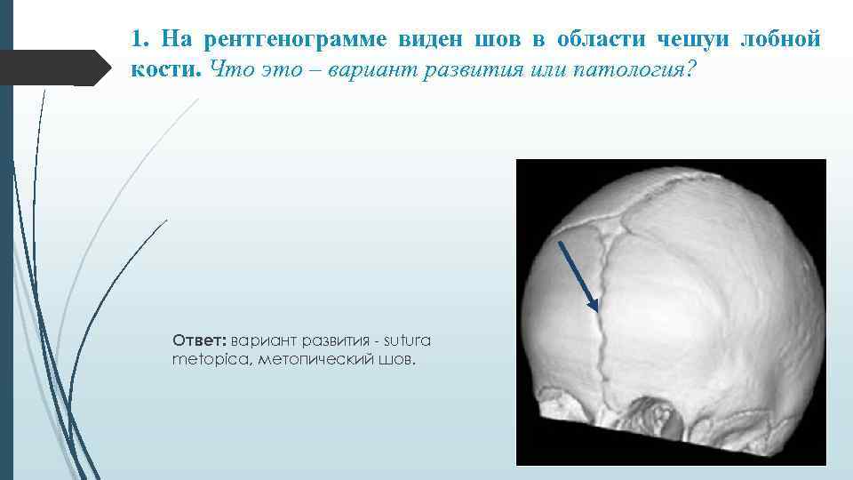 Врожденные аномалии костей черепа нмо ответы