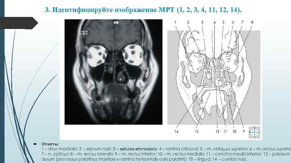 3. Идентифицируйте изображение МРТ (1, 2, 3, 4, 11, 12, 14). Ответы: 1 –