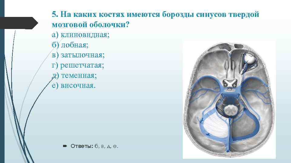 Схема синусов твердой мозговой оболочки