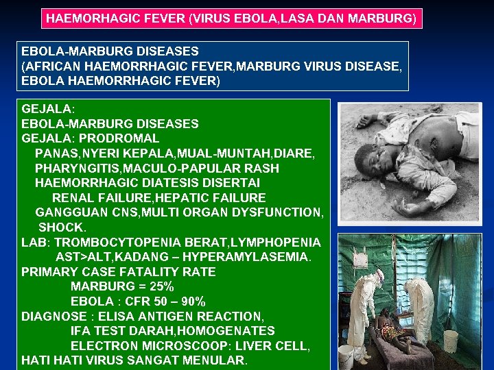 HAEMORHAGIC FEVER (VIRUS EBOLA, LASA DAN MARBURG) EBOLA-MARBURG DISEASES (AFRICAN HAEMORRHAGIC FEVER, MARBURG VIRUS