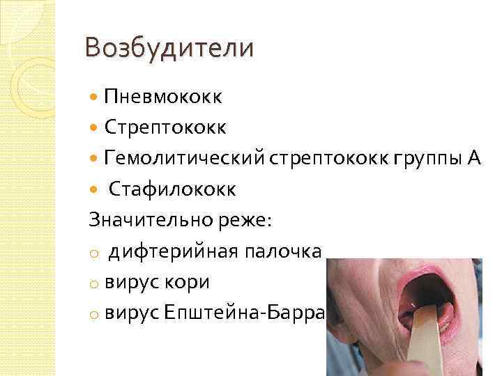 Возбудители Пневмококк Стрептококк Гемолитический стрептококк группы А Стафилококк Значительно реже: o дифтерийная палочка o
