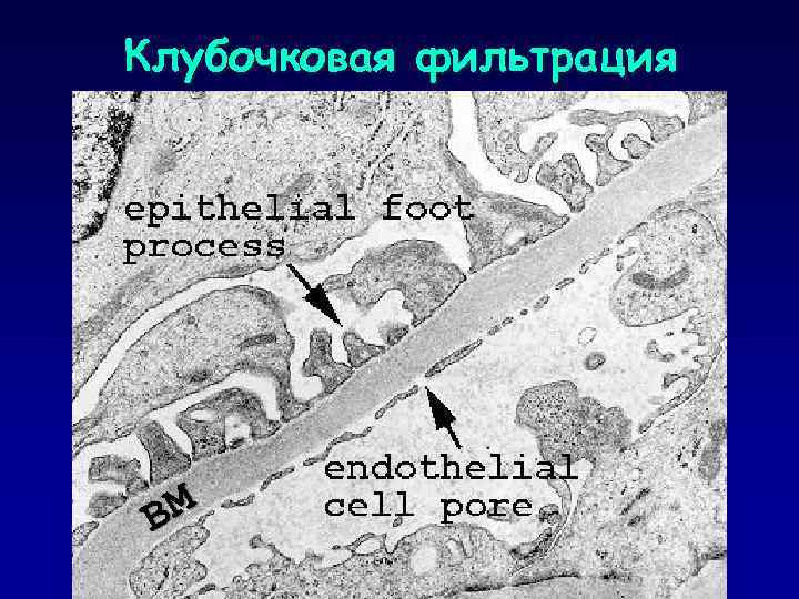 Клубочковая фильтрация ВМ 