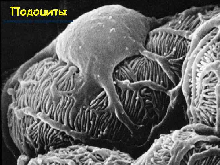 Подоциты Сканирующая электроннограмма 