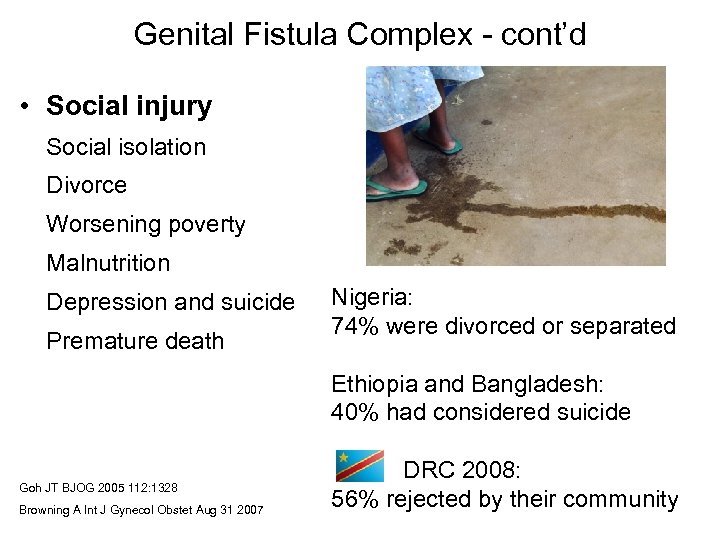 Genital Fistula Complex - cont’d • Social injury Social isolation Divorce Worsening poverty Malnutrition