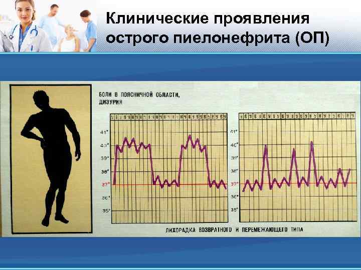 Клинические проявления острого пиелонефрита (ОП) 