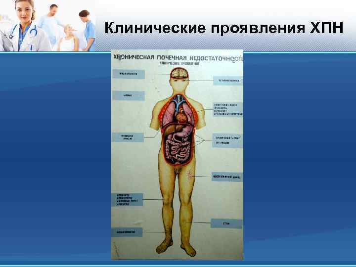 Клинические проявления ХПН 