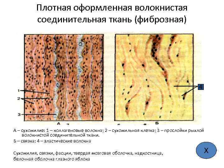 Плотная оформленная волокнистая соединительная ткань (фиброзная) 4 А – сухожилие: 1 – коллагеновые волокна;