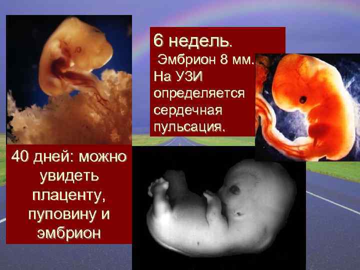 6 недель. 40 дней: можно увидеть плаценту, пуповину и эмбрион Эмбрион 8 мм. На