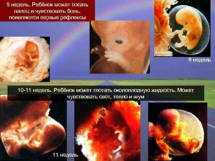 9 недель. Ребёнок может сосать палец и чувствовать боль, появляются первые рефлексы 8 недель