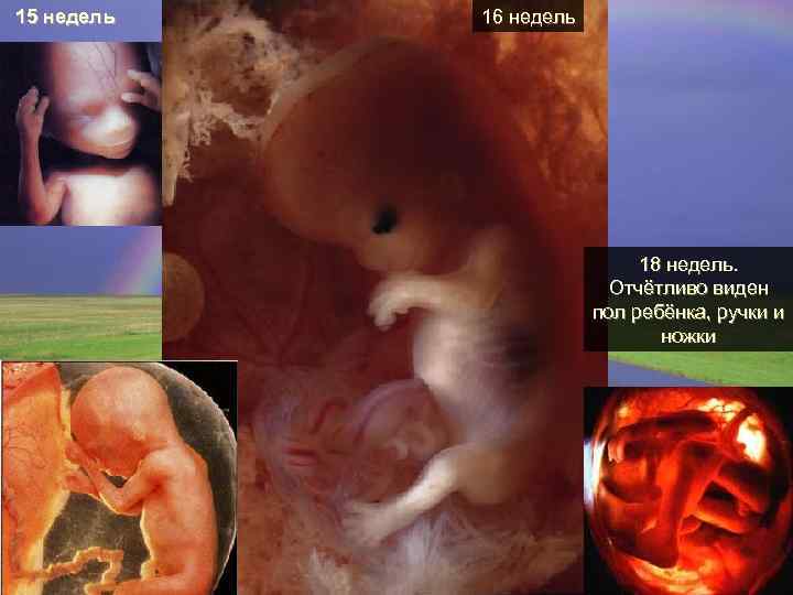 15 недель 16 недель 18 недель. Отчётливо виден пол ребёнка, ручки и ножки 