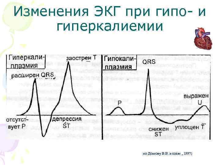 Изменения ЭКГ при гипо- и гиперкалиемии (по Долгову В. В. и соавт. , 1997)