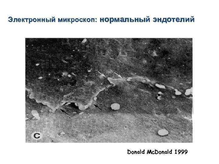 Электронный микроскоп: нормальный эндотелий Donald Mc. Donald 1999 