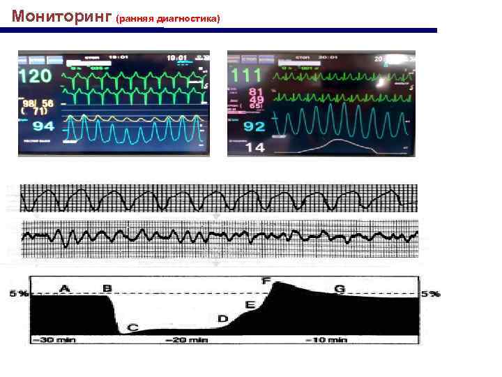 Мониторинг (ранняя диагностика) 