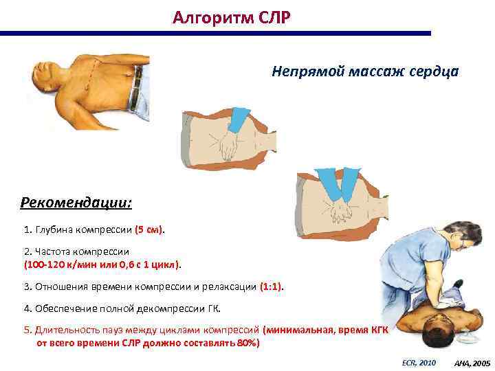 Частота непрямого. Алгоритм сердечно-легочной реанимации 1 непрямой массаж сердца. Алгоритм проведения реанимации непрямого массажа сердца. Частота компрессий при сердечно-легочной реанимации. Сердечно легочная реанимация не прямой массад алгоритм.