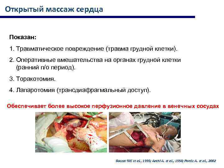 Открытый массаж сердца Показан: 1. Травматическое повреждение (травма грудной клетки). 2. Оперативные вмешательства на