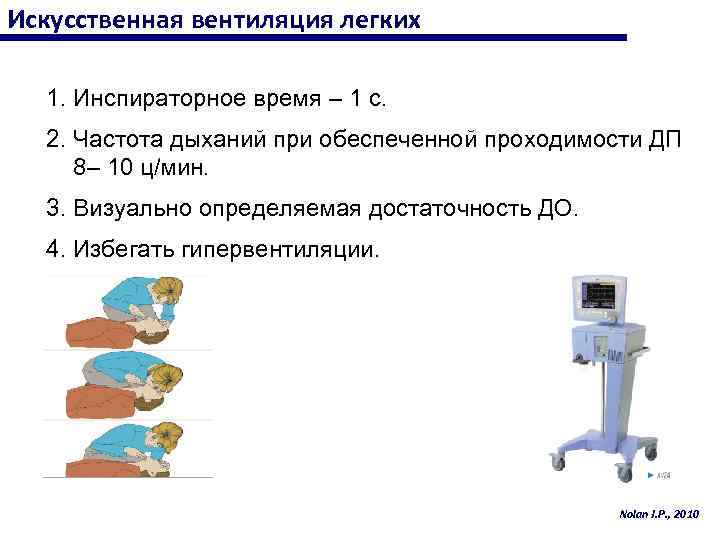 Искусственная вентиляция легких 1. Инспираторное время – 1 с. 2. Частота дыханий при обеспеченной