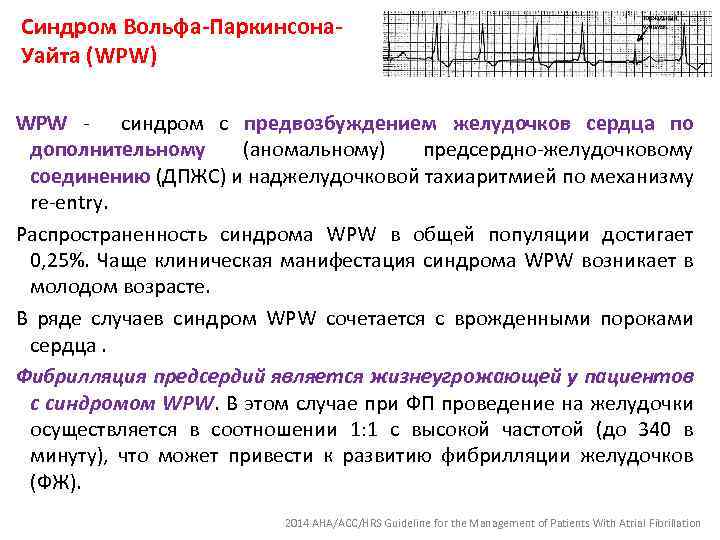 Синдром Вольфа-Паркинсона. Уайта (WPW) WPW - синдром с предвозбуждением желудочков сердца по дополнительному (аномальному)