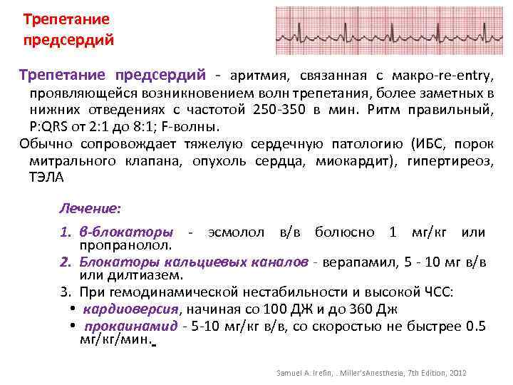 Трепетание предсердий - аритмия, связанная с макро-re-entry, проявляющейся возникновением волн трепетания, более заметных в