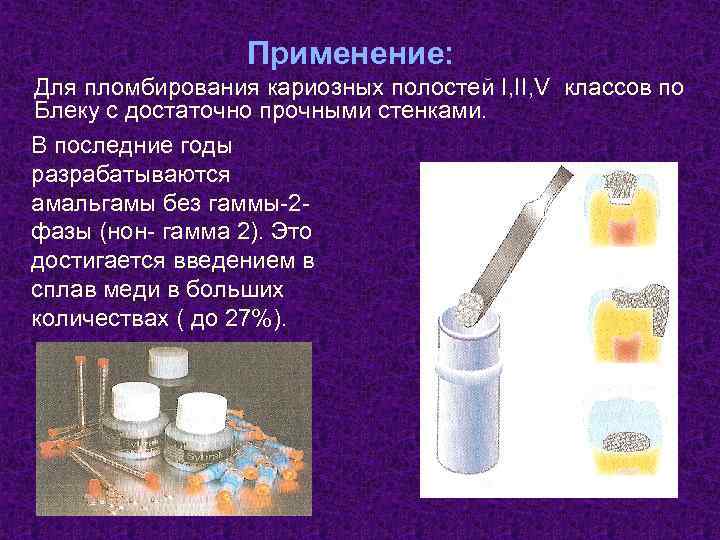 Пломбирование кариозных полостей v класса. Пломбирование кариозных полостей материалы. Пломбировочных материалов для пломбировании кариозной полости. Для пломбирования полости II класса по Black применяют:. Инструментарий для пломбирования кариозных полостей и материалы.