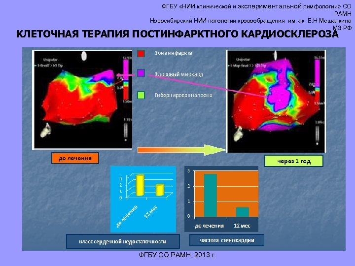 ФГБУ «НИИ клинической и экспериментальной лимфологии» СО РАМН Новосибирский НИИ патологии кровообращения им. ак.
