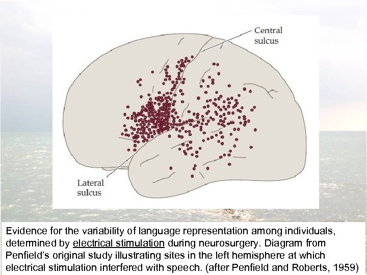 Evidence for the variability of language representation among individuals, determined by electrical stimulation during