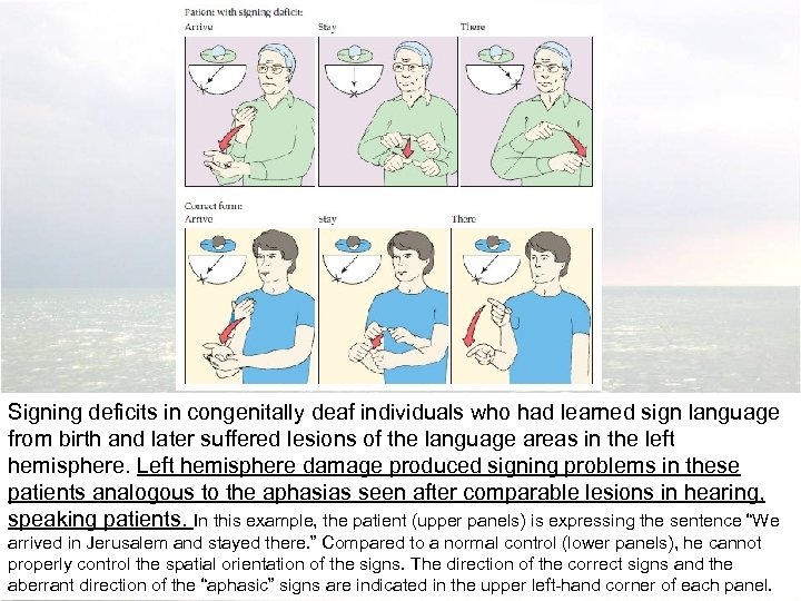Signing deficits in congenitally deaf individuals who had learned sign language from birth and
