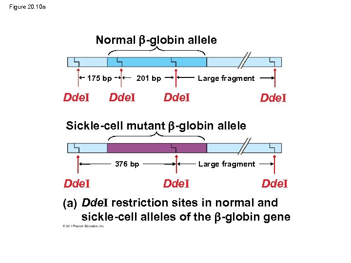 Figure 20. 10 a Normal -globin allele 175 bp Dde. I Large fragment 201