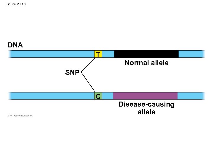 Figure 20. 16 DNA T Normal allele SNP C Disease-causing allele 