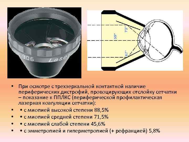  • При осмотре с трехзеркальной контактной наличие периферических дистрофий, провоцирующих отслойку сетчатки –